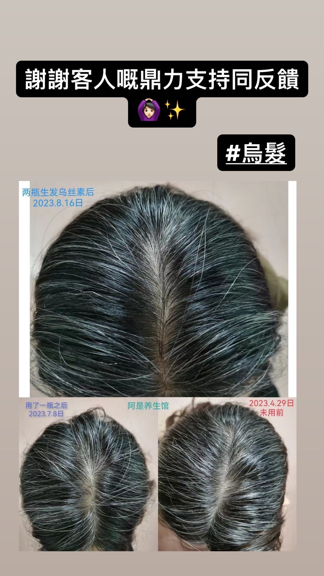 CHAISENTOMG HEALTHY HAIR