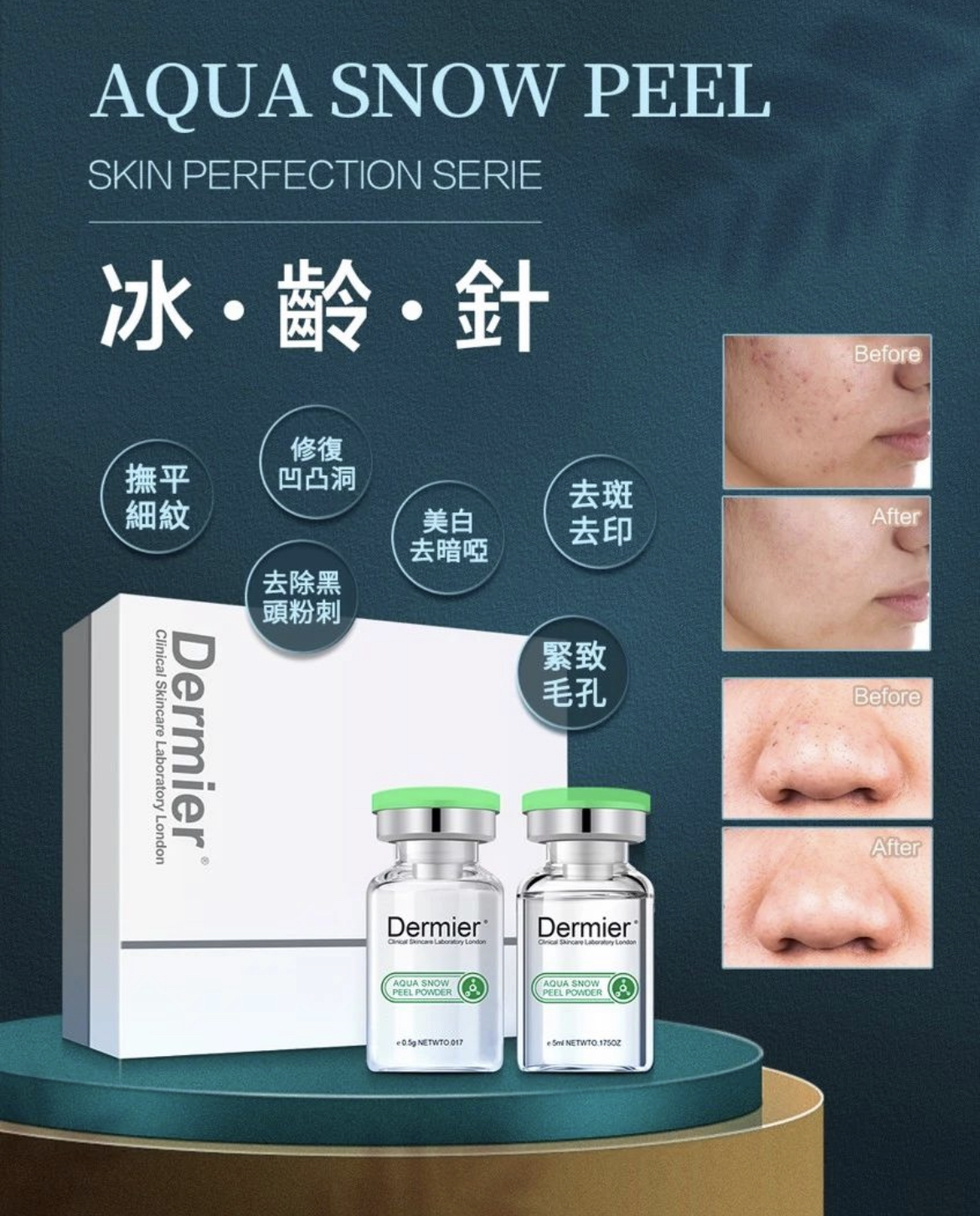 Dermier- 冰齡針套裝Aqua snow peel(1盒(6set冰齡針＋6片C60閃鑽急救面膜＋1枝骨膠原精華）