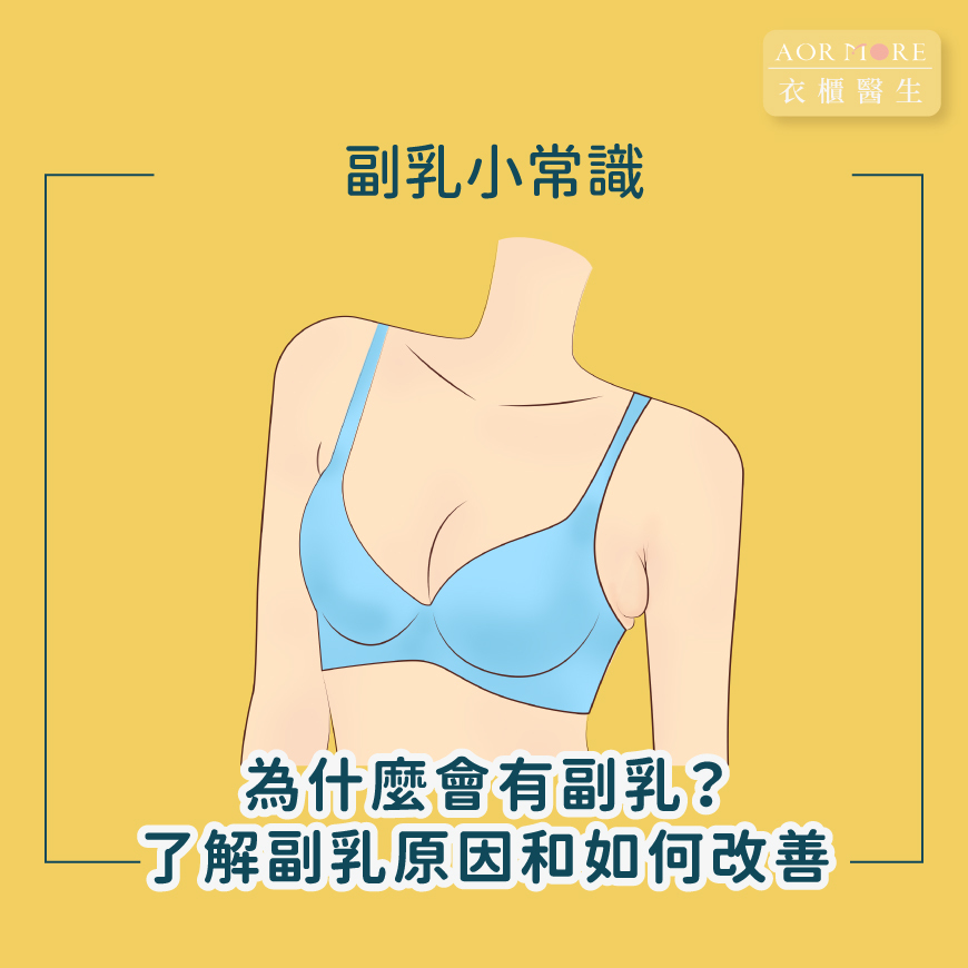 副乳是什麼?