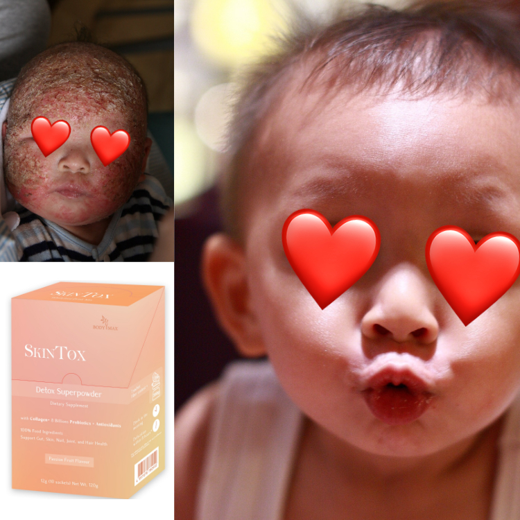 SkinTox 燃燒腹部脂肪 (強效消肚腩)、快速減重、燒脂瘦全身、活腸排宿便、軟便舒暢清