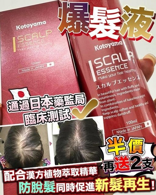日本Kotoyama爆髮液 (買1送2)