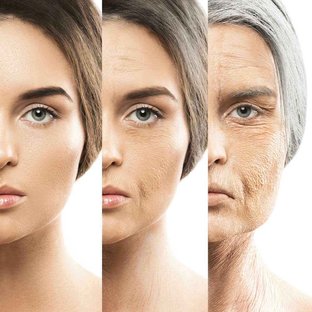 抗老保養前，先了解皮膚老化的14種特徵