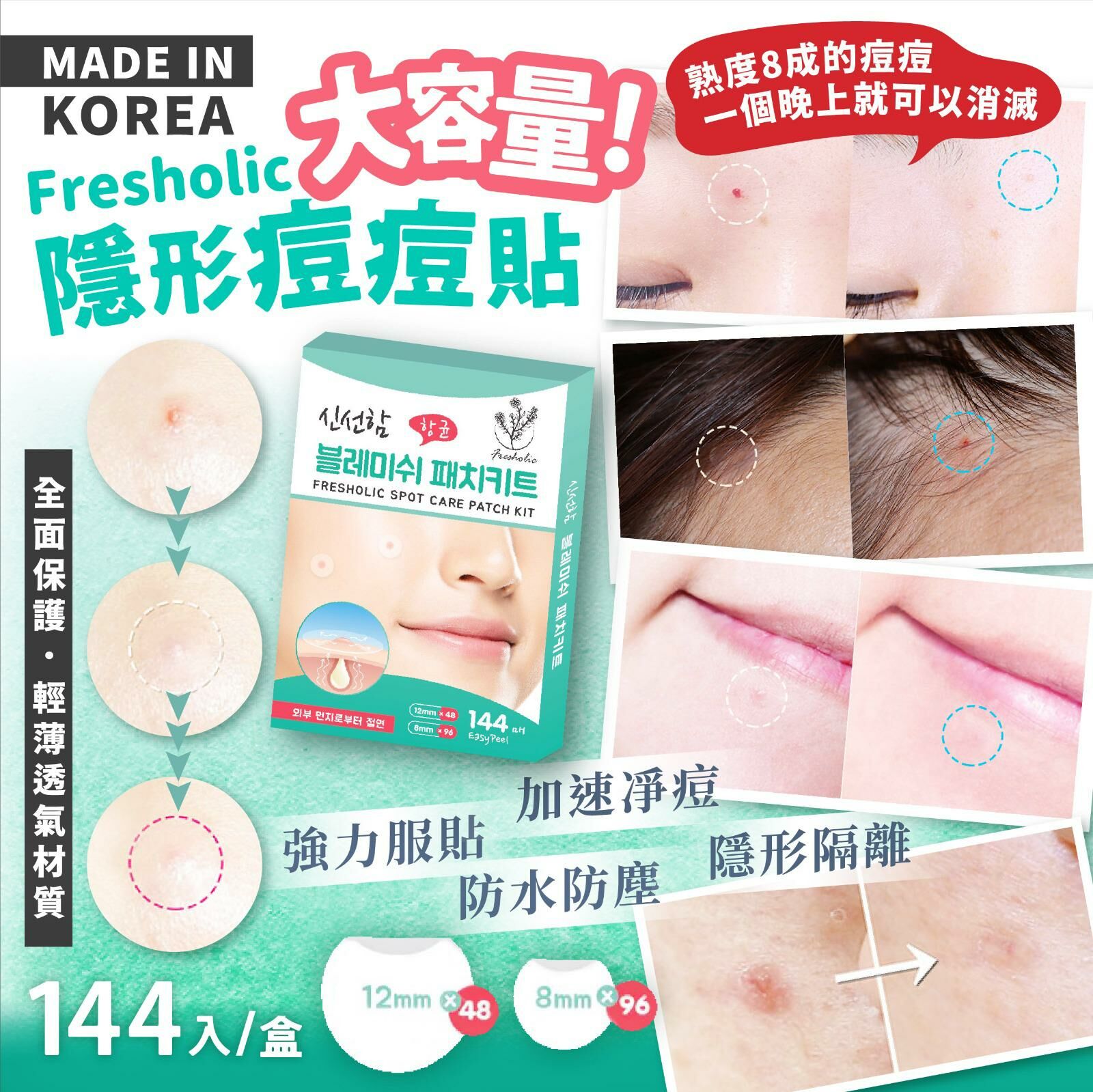 韓國製造Fresholic隱形痘痘貼大容量144入(盒)1組2盒