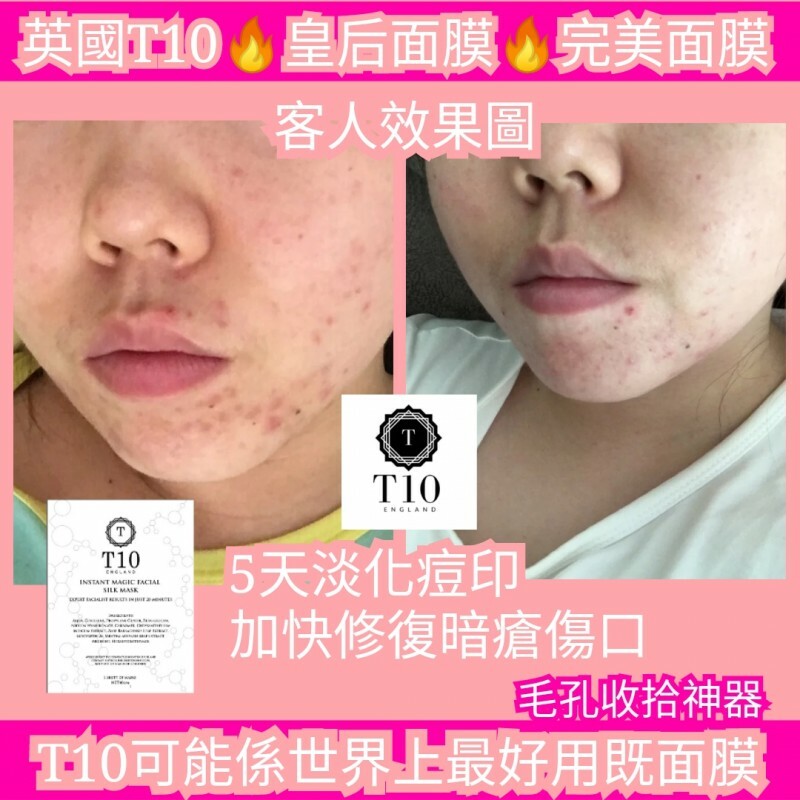 WSBA1944 英國T10 Mask 皇后面膜（1盒5片）（現貨A15）