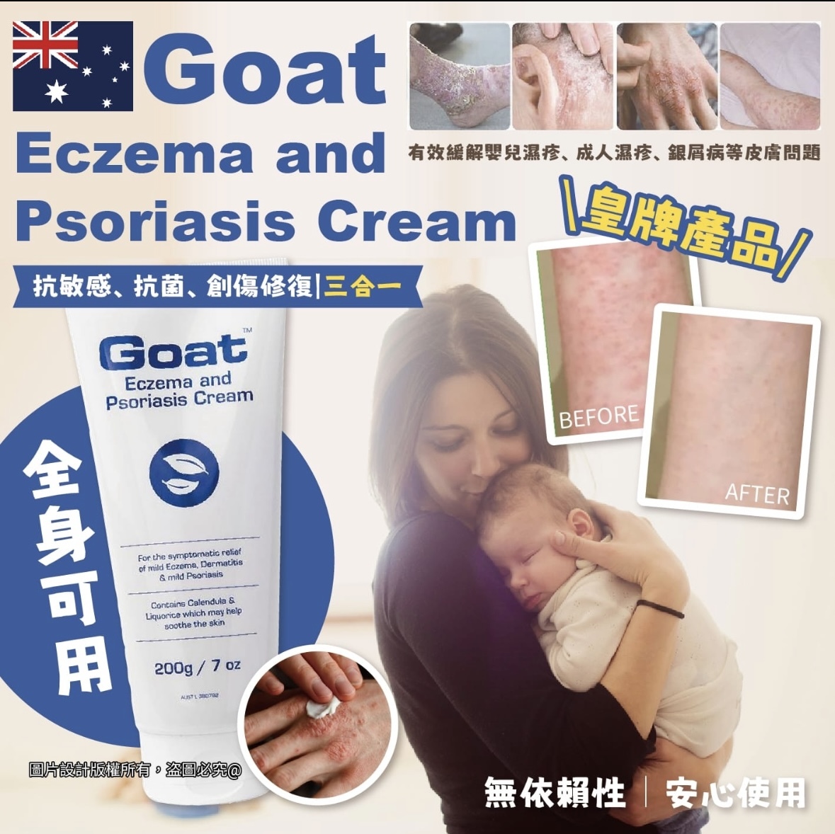 Goat Eczema And Psoriasis Cream 濕疹膏