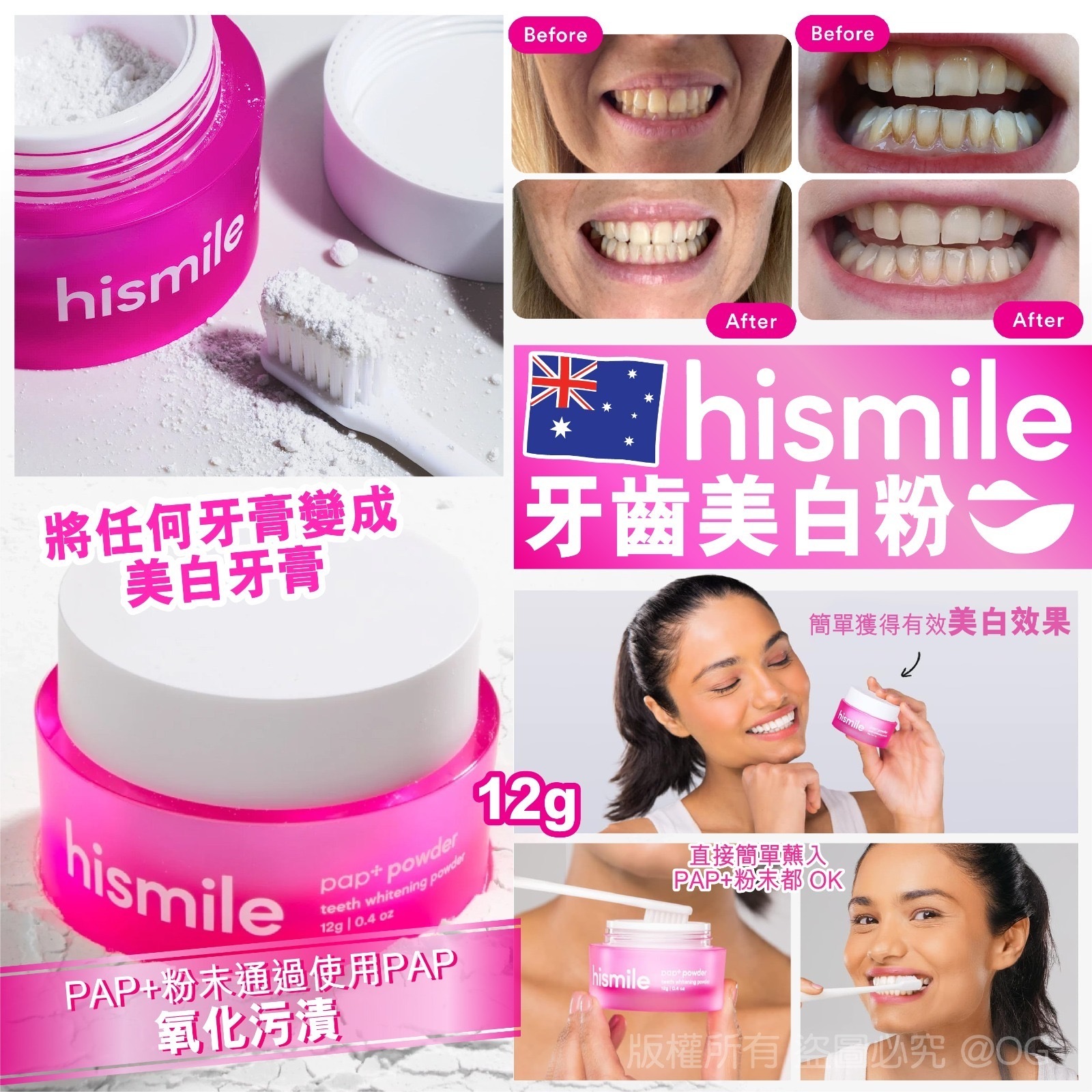 澳洲Hismile牙齒美白粉12g