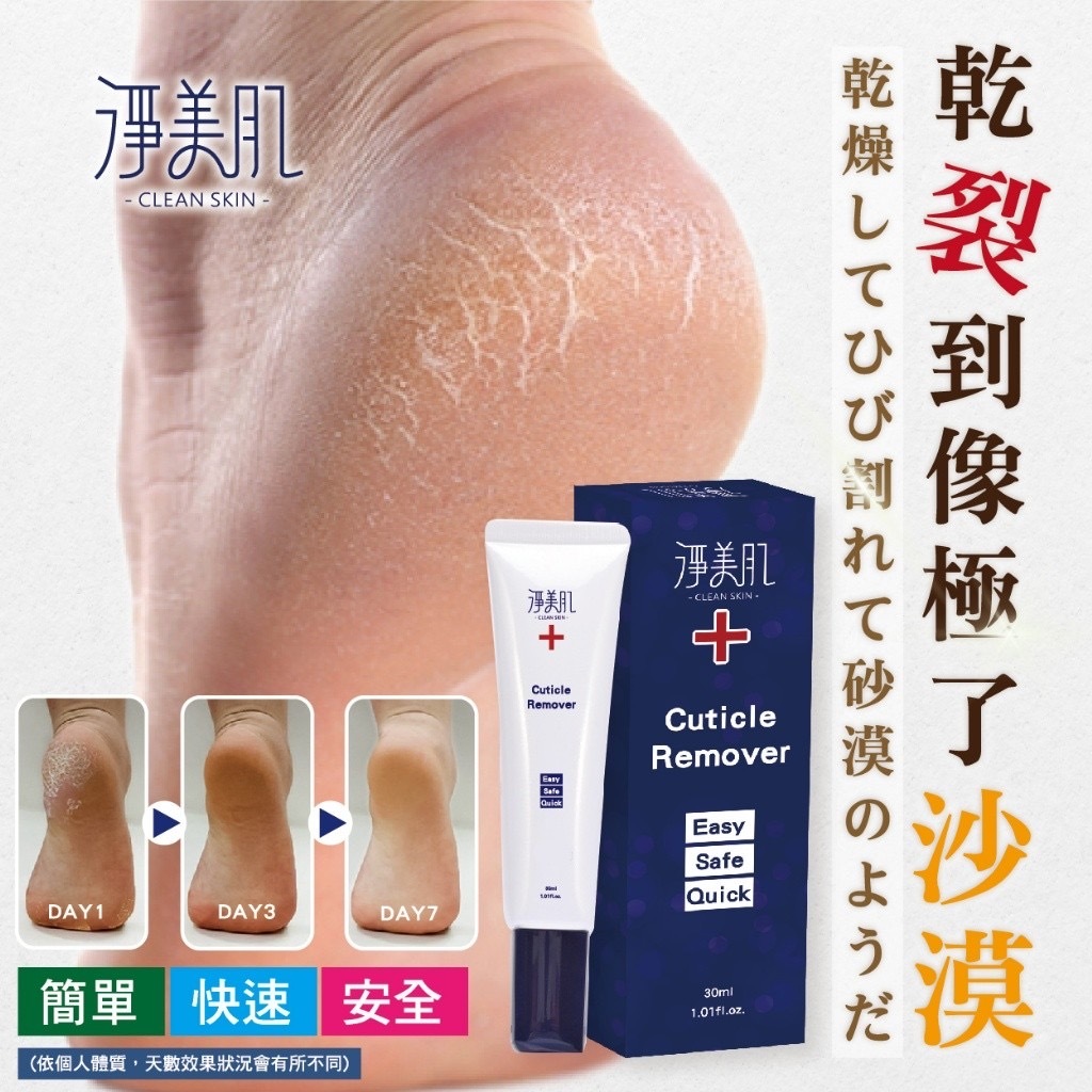 淨美肌死皮角質軟化液30ML