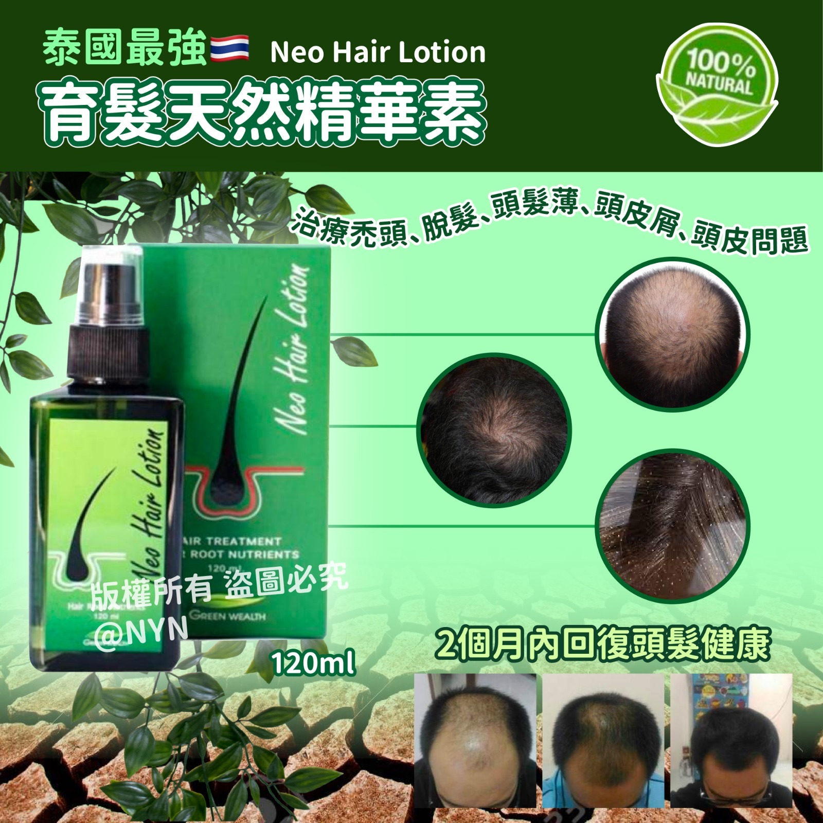 泰國最強生髮水育髮天然精華素