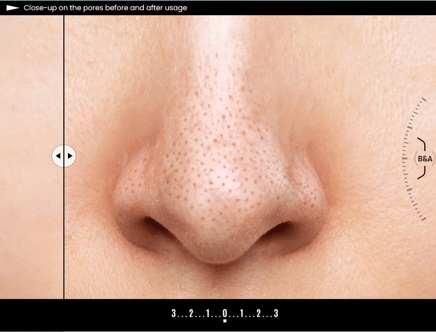 《現貨》ilso Super Melting Serum Softener 150mL Special Set (Special Gift: Gotton Pad 40P)