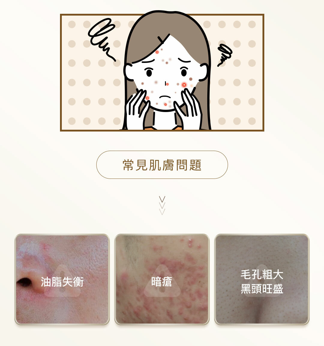 黃芩抗炎消痘精華,精華,袪痘,消炎,抗敏,抗炎,護膚,暗瘡,暗瘡肌,痘痘