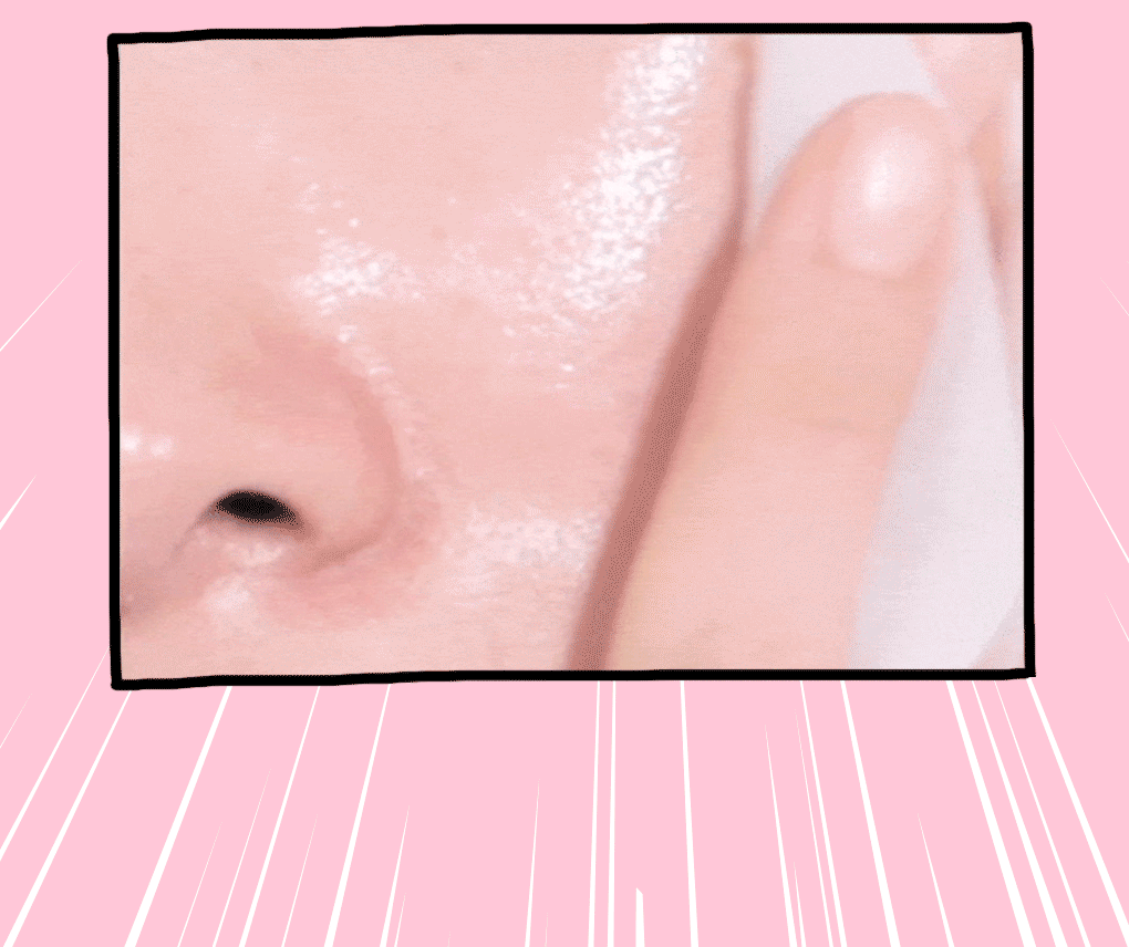 《現貨》MEDIHEAL Madecassoside Blemish Pad 100P Special Set 1+1 +10p+10P PDRN