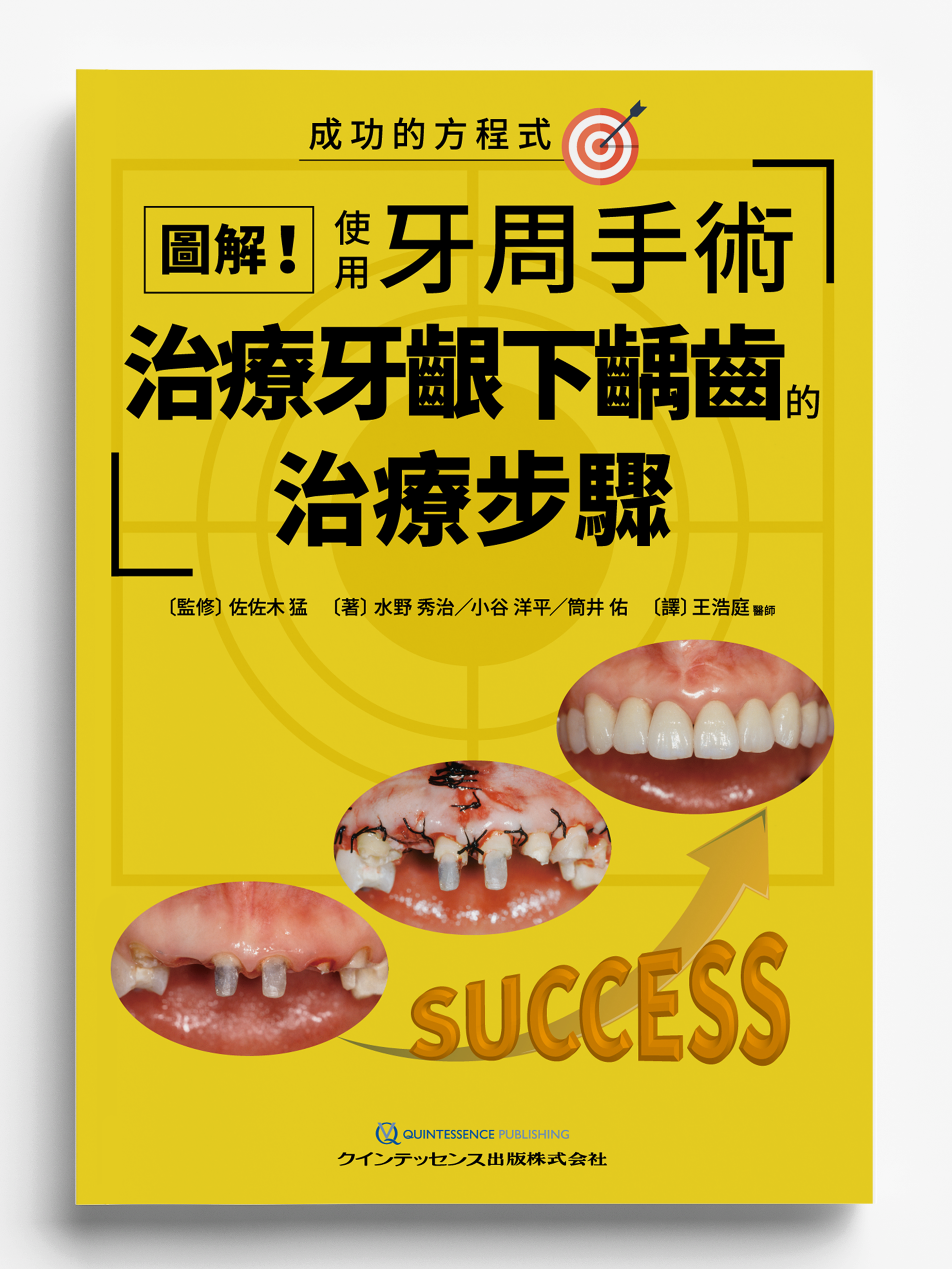 《圖解!使用牙周手術治療牙齦下齲齒的治療步驟》日文書譯版