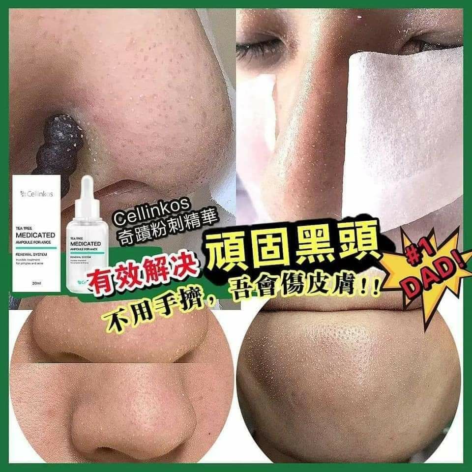 cc7013 粉刺補水精華 $99/1 $190/2