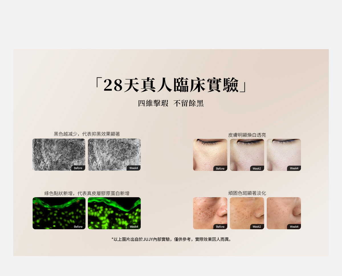 JUJY 牛奶光嫩透肌提亮淡斑逆齡美容儀| 送 2盒面膜| 原裝行貨一年保養＋ X Luxury 超級磨皮水美白精華 ＋Sliswiss 白藜蘆醇HIFU GEL