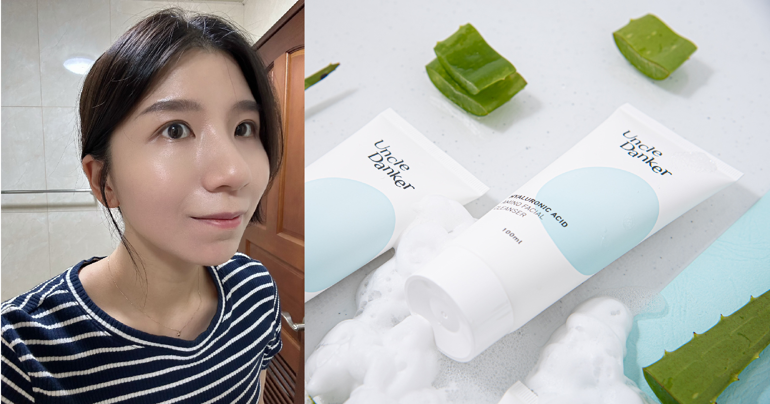 醫美雷射術後多久可以洗臉？洗面乳怎麼挑？做好術後保養療程效果好30%！