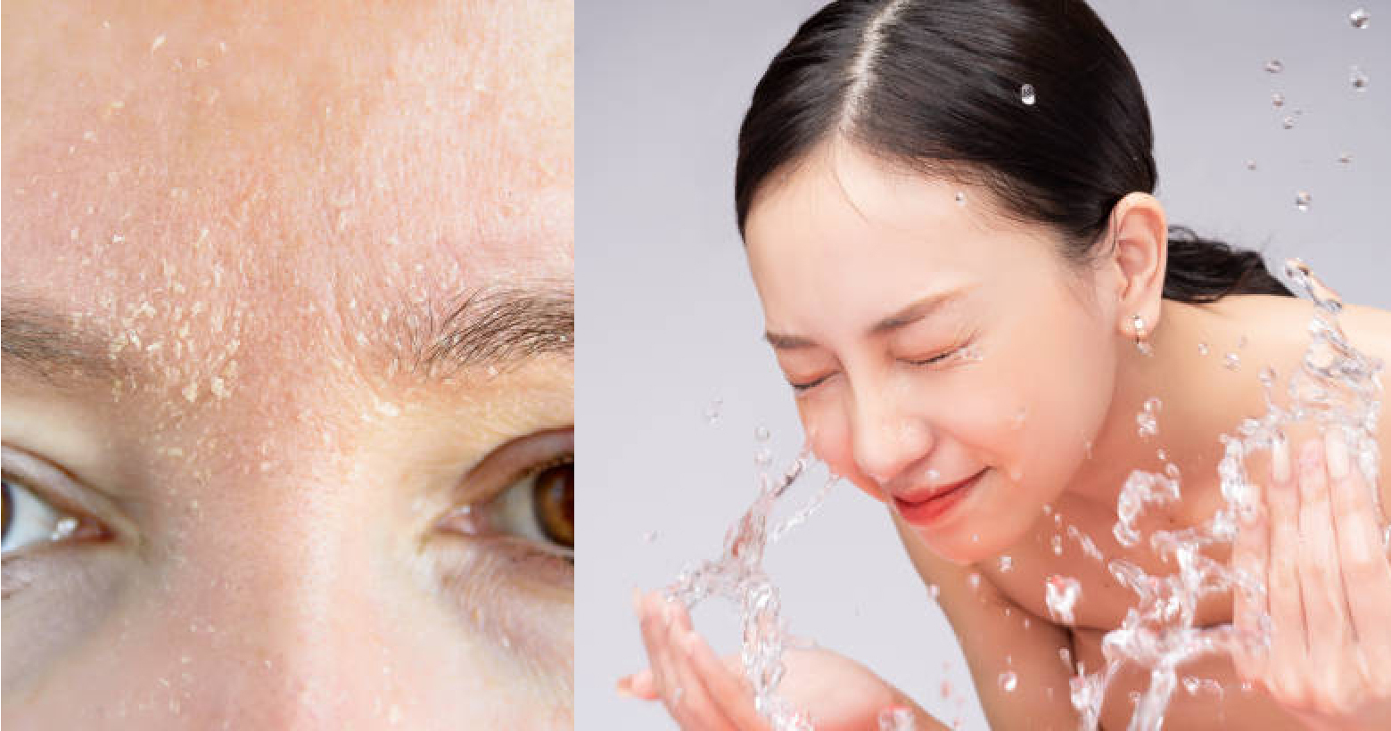 乾肌洗面乳推薦｜洗臉方式教學、應避免成分一次統整