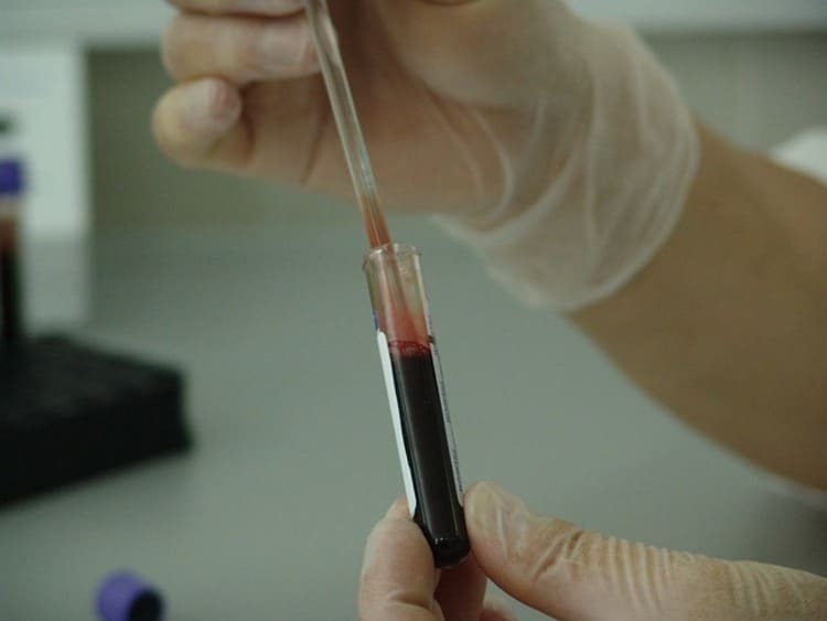 一個試管裡裝著血液，象徵建議大家定期做健檢
