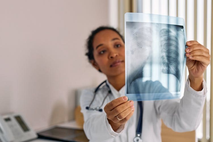 一位醫師拿著剛做完全身健檢的X光
