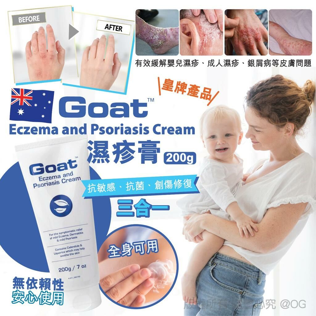 現貨 Goat Eczema And Psoriasis Cream 濕疹膏 200g