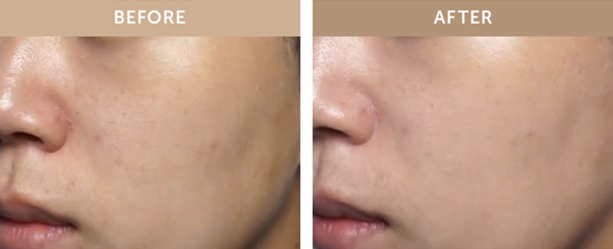 韓國 Klairs瓷光BB霜官方使用前後對比照