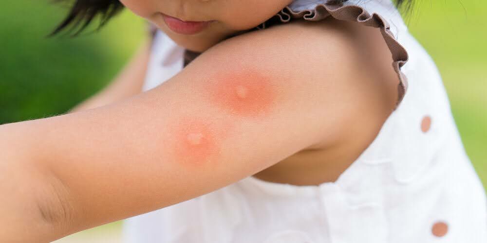 防蚊液可以防小黑蚊嗎