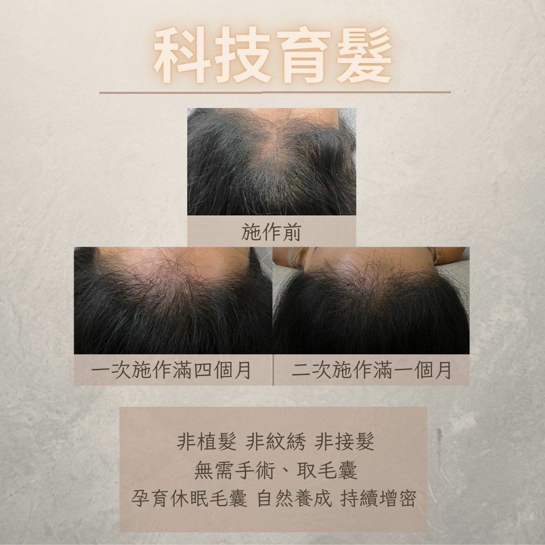 科技育髮作品，98HAIR 提供