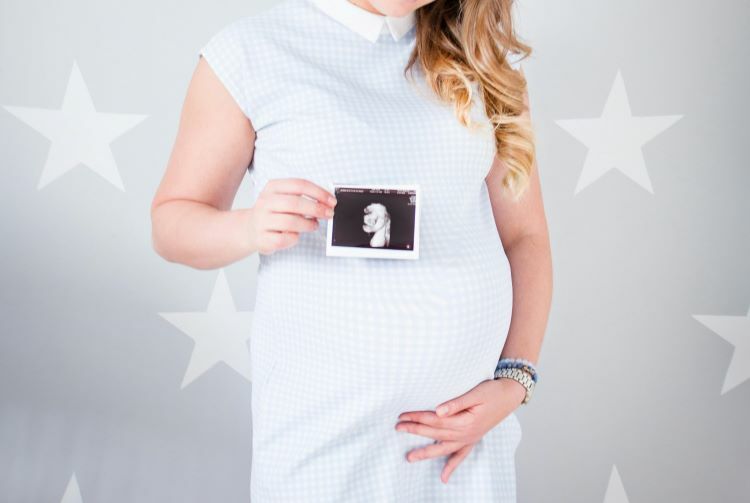 孕婦手持寶寶的超音波照。