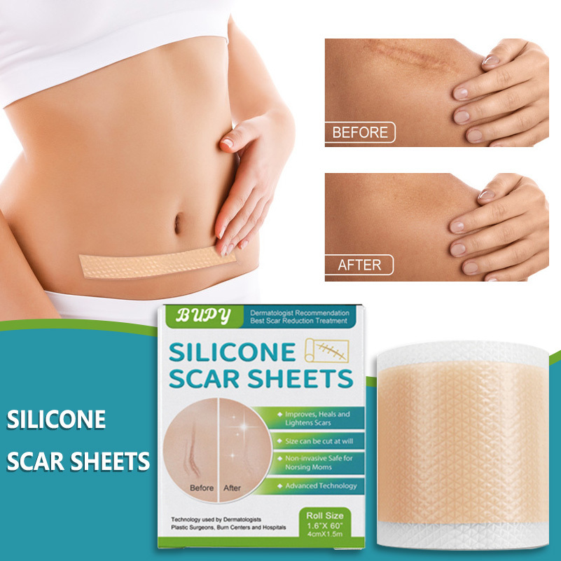 BUBY - 矽膠去疤片  (150x4 cm) 防水淡化 新傷舊傷妊娠紋 傷疤貼A