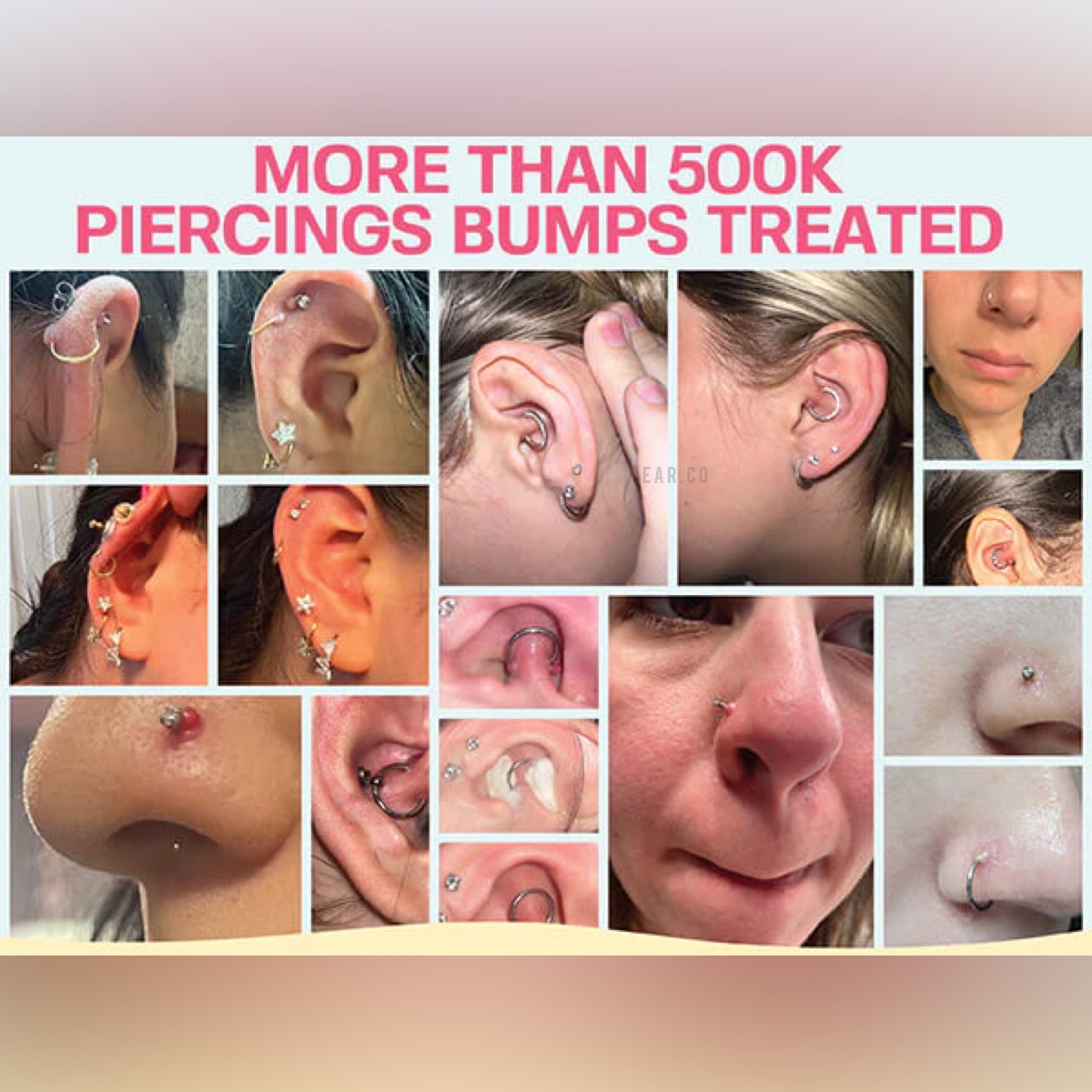 BASE LAB 穿孔增生/囊腫治療啫喱 Bump Removal Gel 60g