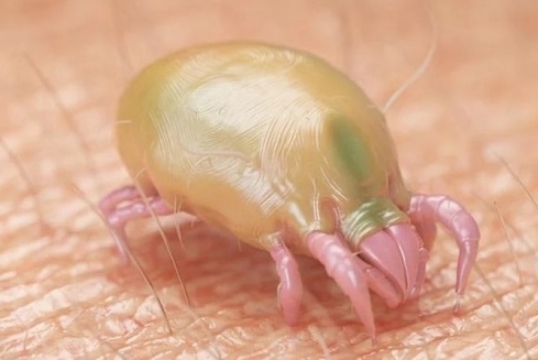 告別疥瘡困擾！床墊清潔保養法，讓你夜夜好眠！