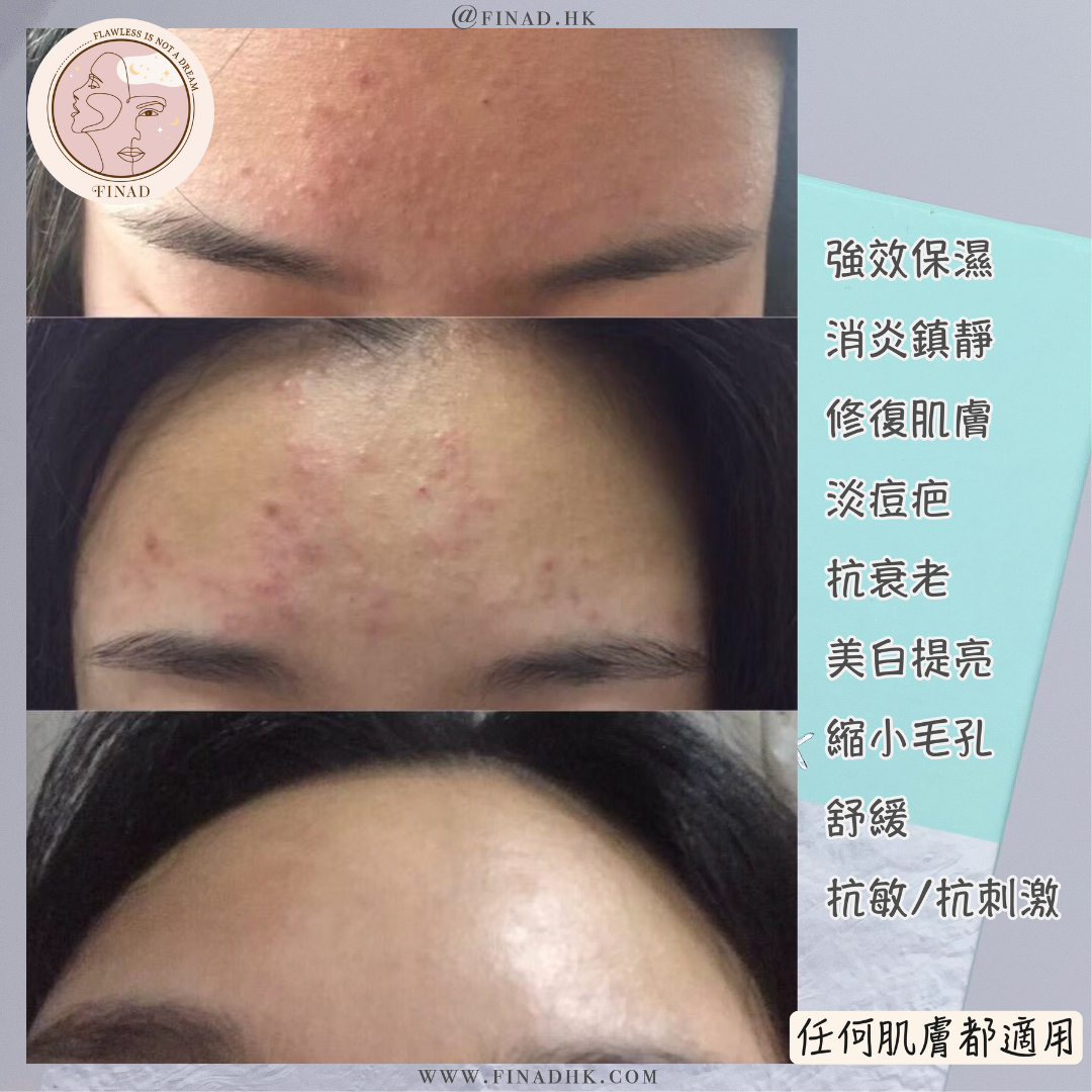 Mevenns 冰雪面膜套裝 (買10 送1)