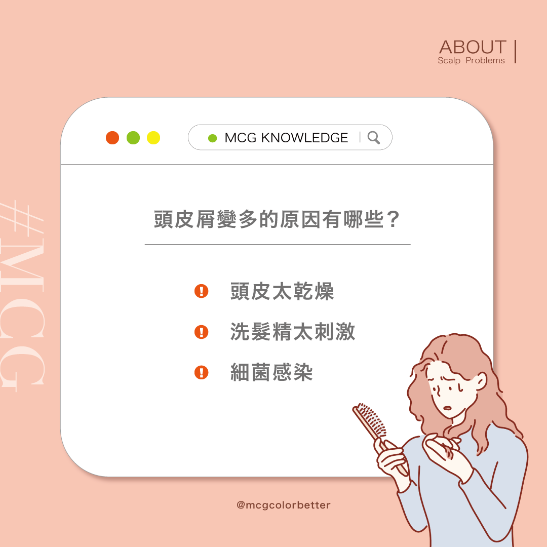 頭皮屑變多的三個原因