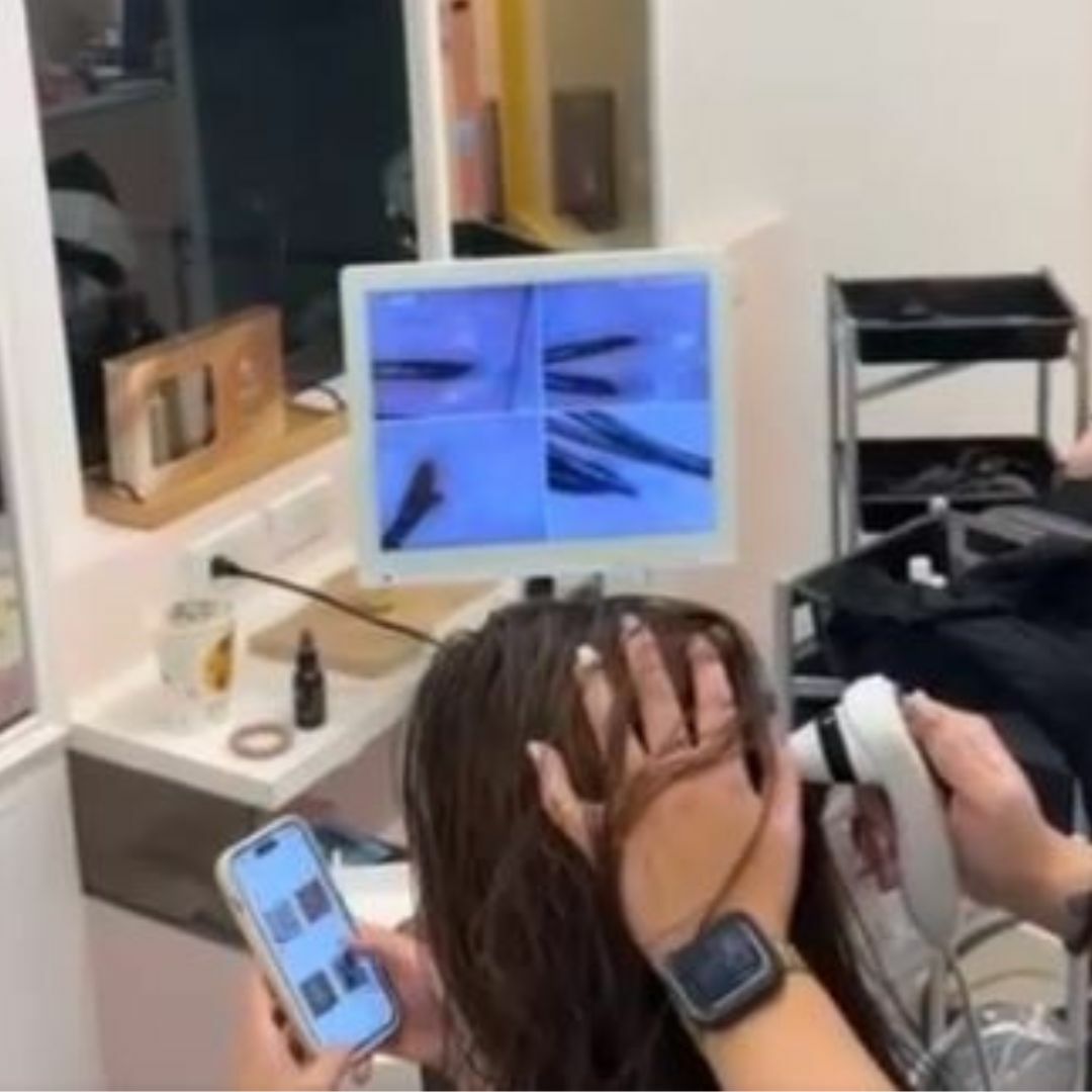 Betty幫客人頭皮檢測-油性頭皮、乾性頭皮、中性頭皮