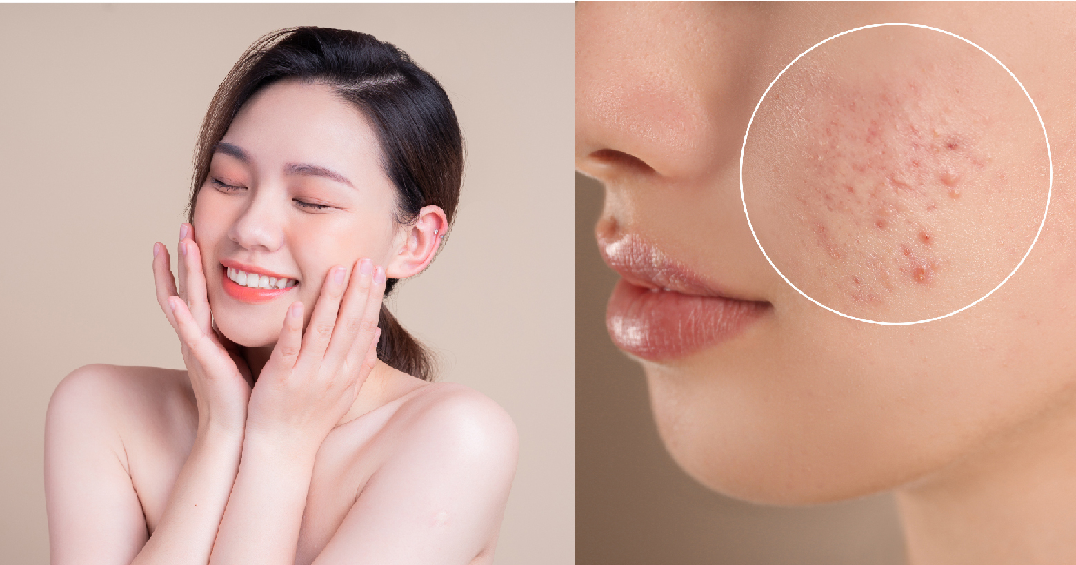 洗面乳有3大功效專家「不推薦」 美白 抗痘 去粉刺 控油都上榜