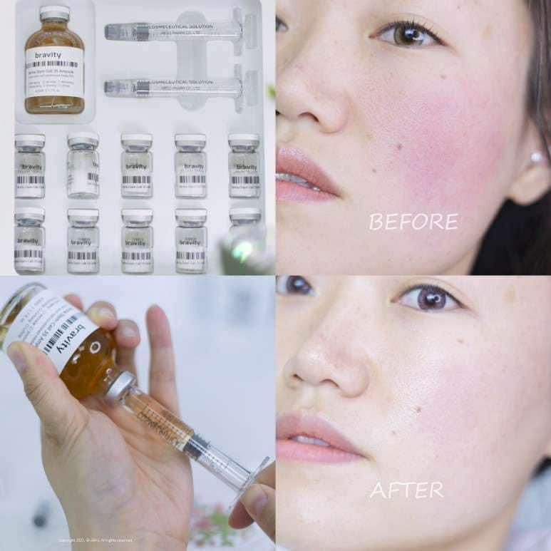 韓國 #Bravity DERMA STEM CELL 35 PROGRAM 羊膜水幹細胞35修護套盒〔