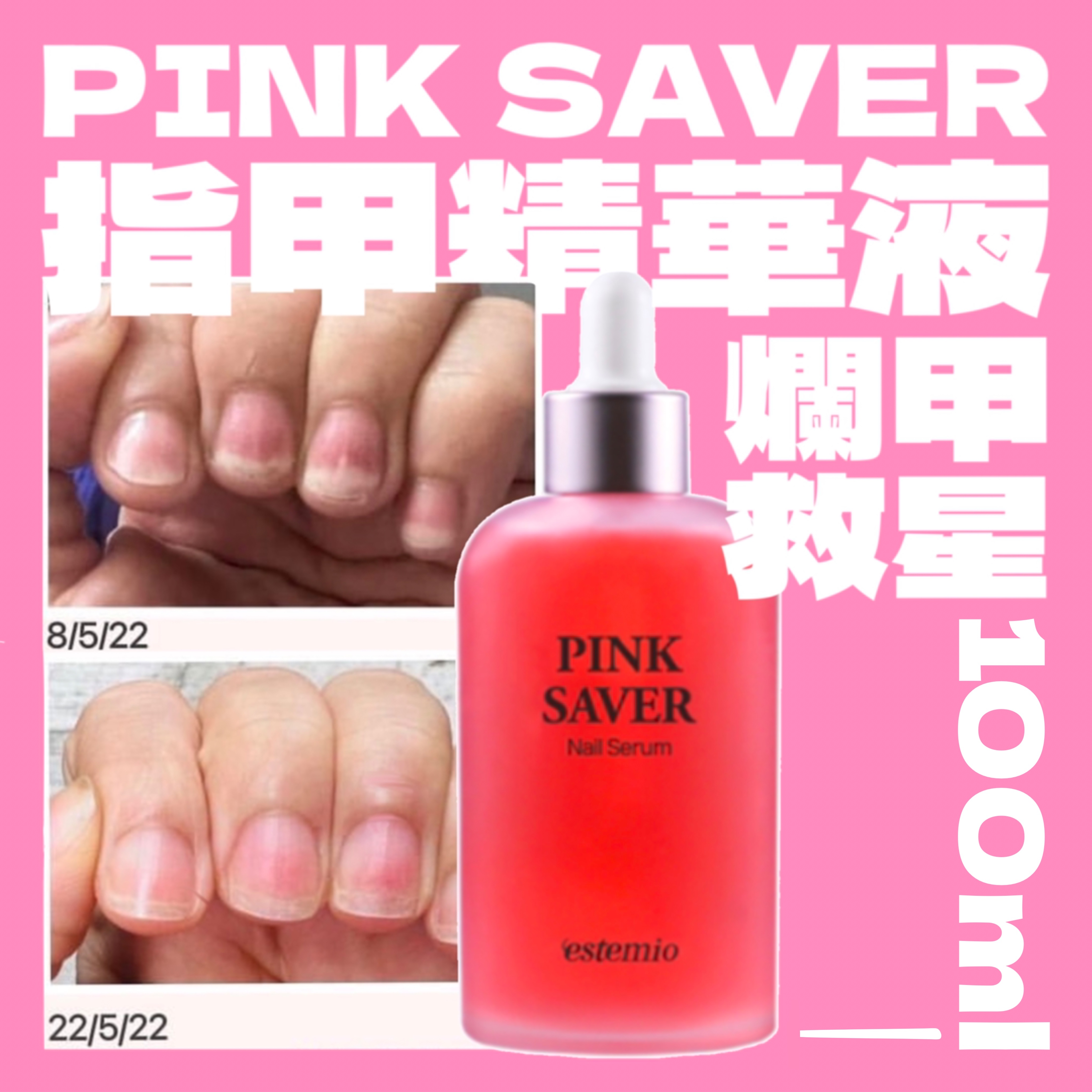 爛甲救星 指甲精華液 Pink Saver Nail Serum 100ml