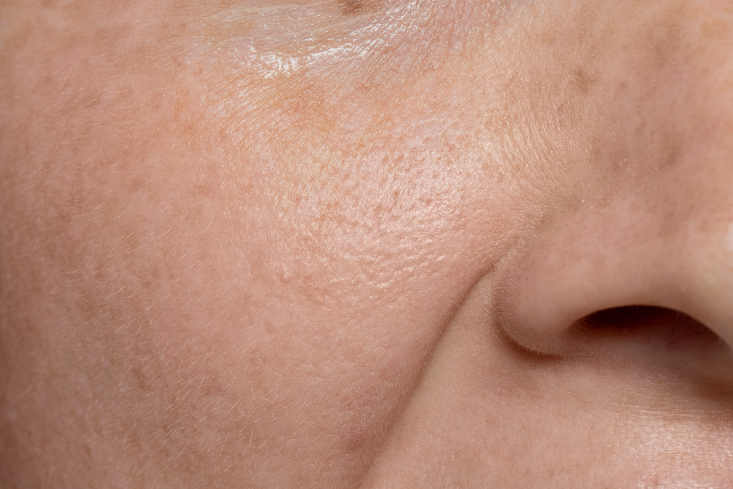 Close up on face pores texture