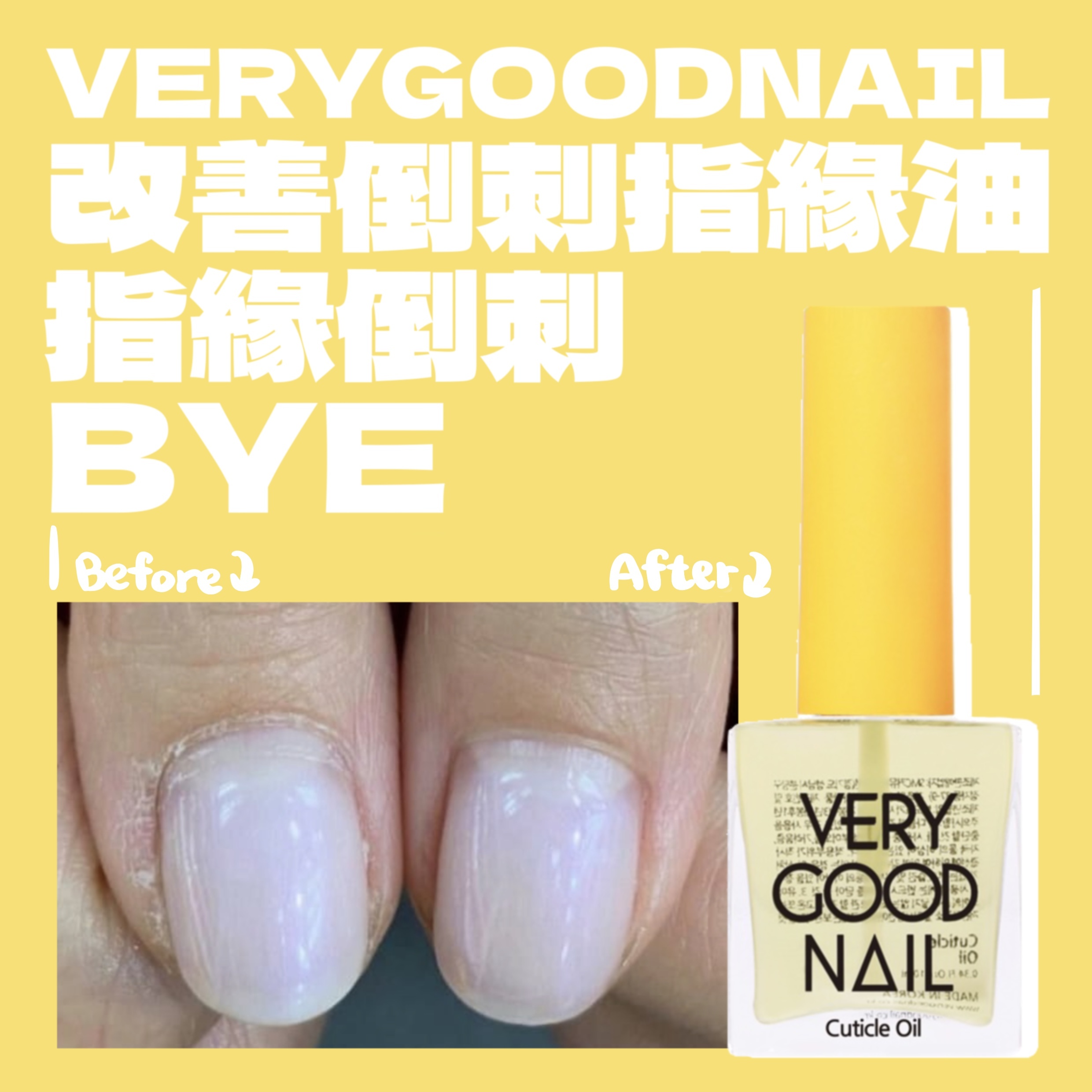 Verygoodnail 倒刺指緣油 10ml