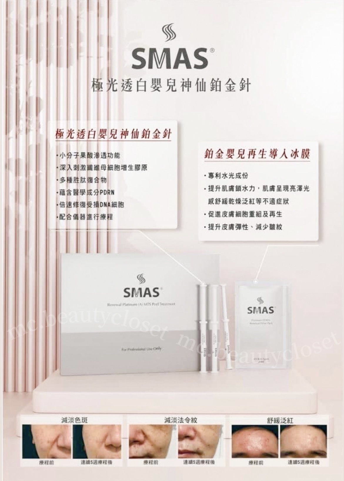SMAS 極光透白嬰兒神仙鉑金針療程