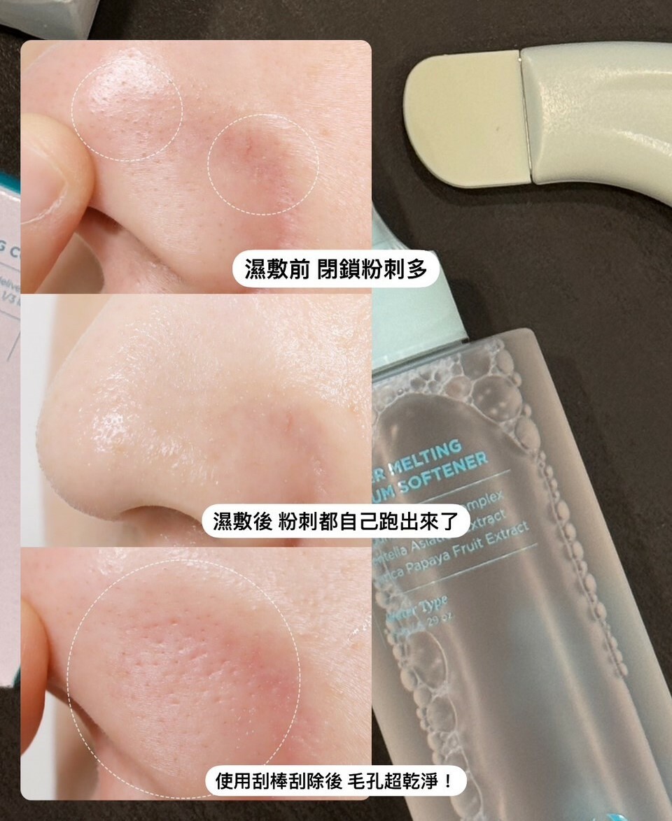 <線上SALE❤️‍🔥> 粉刺清光光😎 韓國 Ilso黑頭粉刺導出液