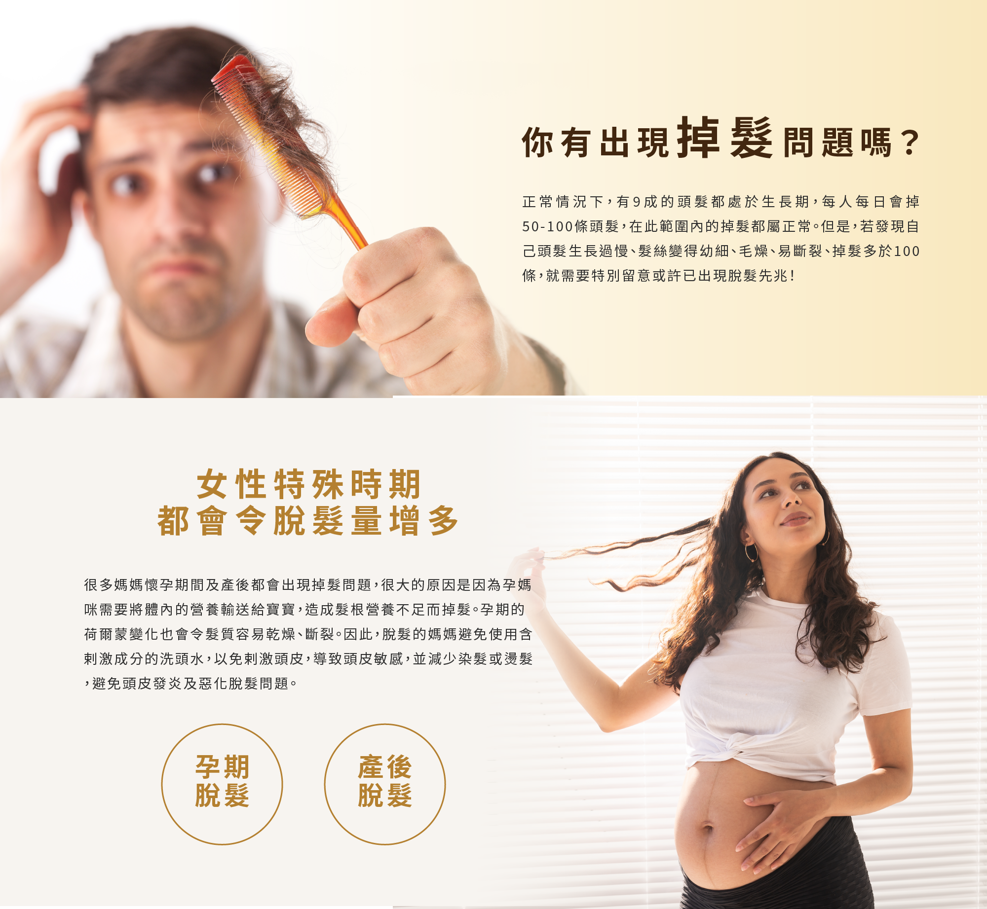 每日多於100條掉髮就要小心脫髮。女性在特殊時期，如懷孕或產後都有機會發生掉髮，避免使用含刺激性的洗頭水，有助減輕掉髮