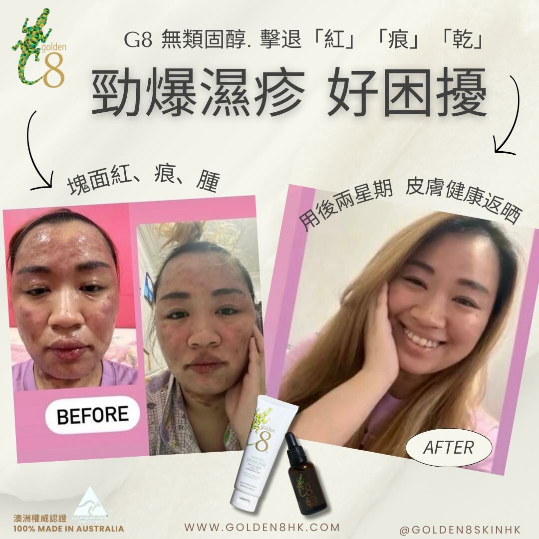 星級、網紅真實用家見證
