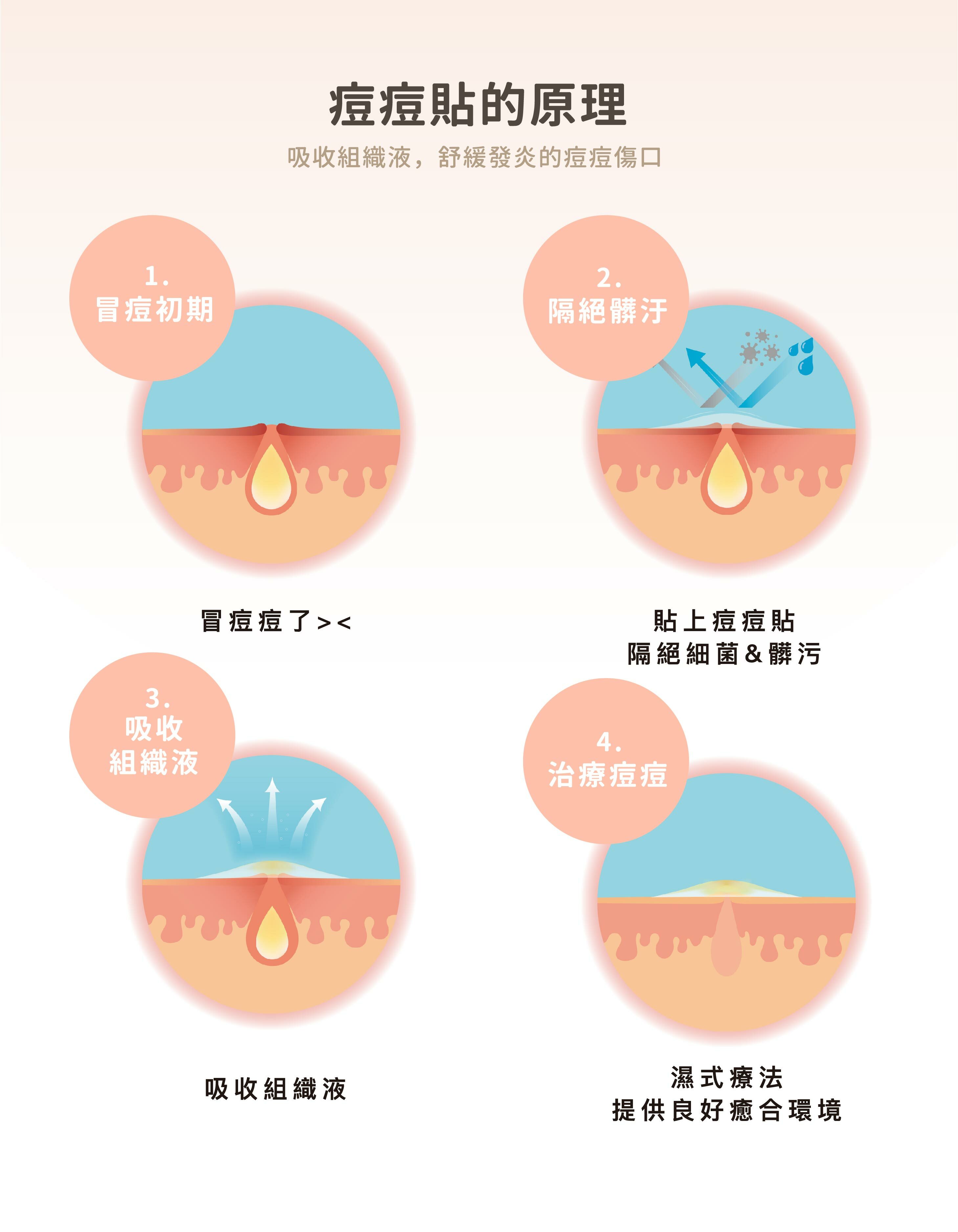 優若美,隱形痘痘貼