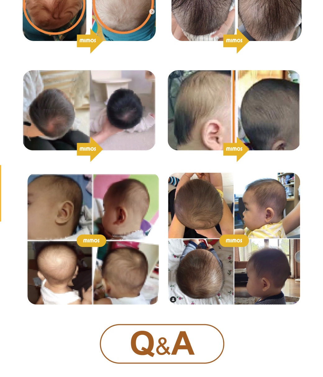 使用MIMOS頭型枕前後比較2