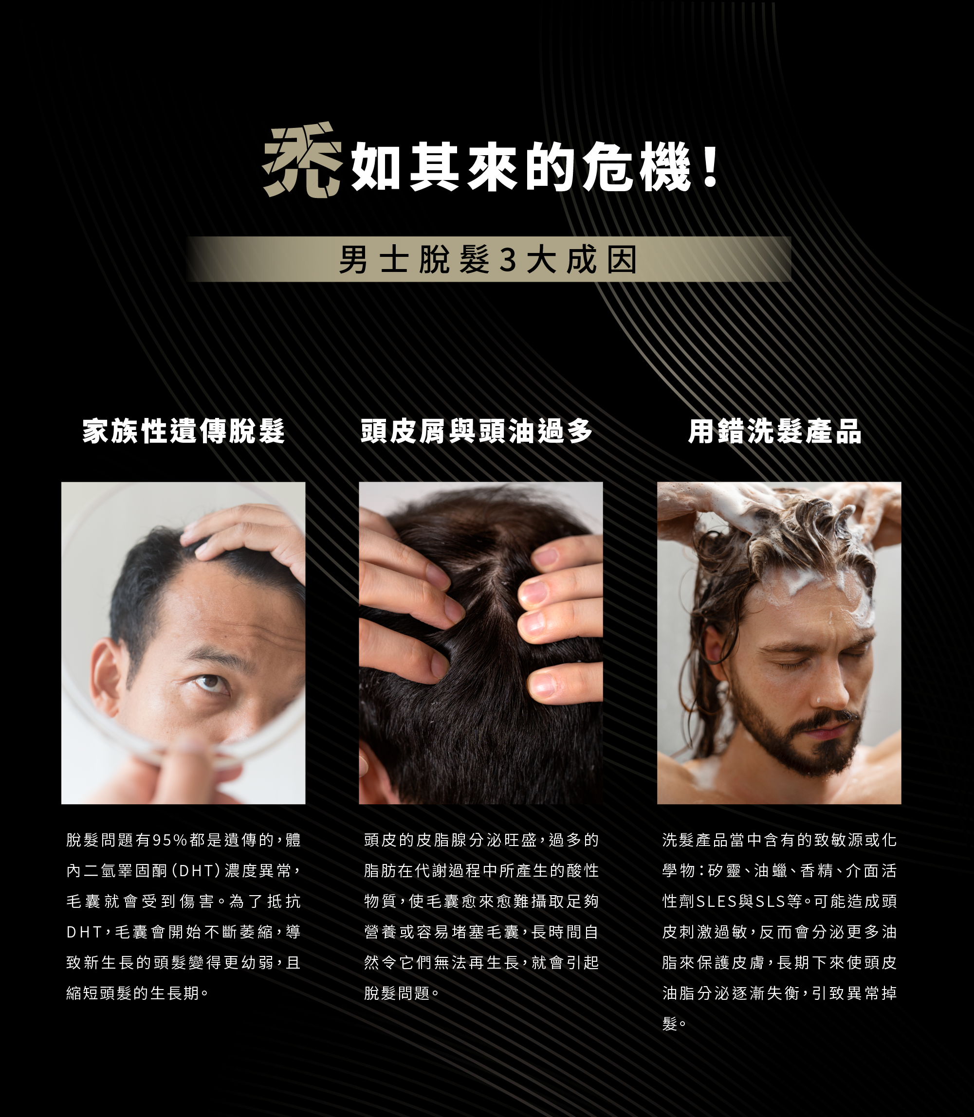 男士最常見的脫髮成因選錯洗髮用品、頭皮油脂過多，以及遺傳