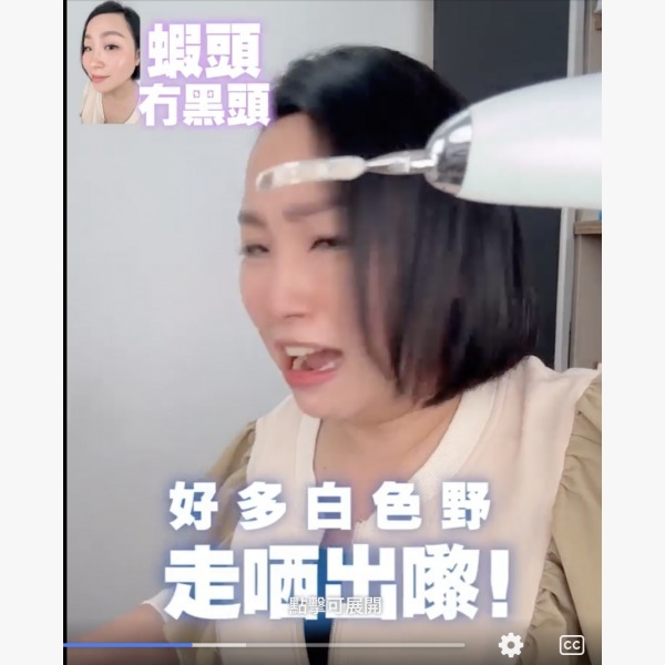 Sofia in wonderland 點震機 蝦頭推介清黑頭粉刺死皮