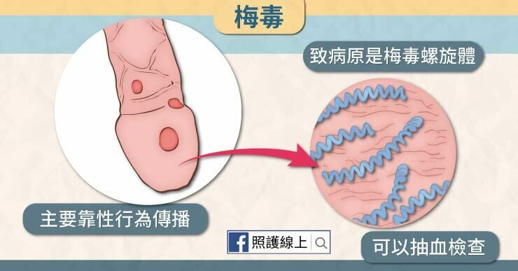 梅毒是如何傳播的？是透過體液、血液傳播，例如與他人進行口交、性交等途徑傳染