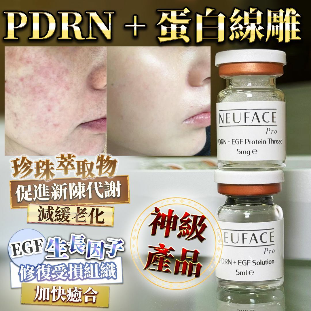 PDRN+蛋白線雕