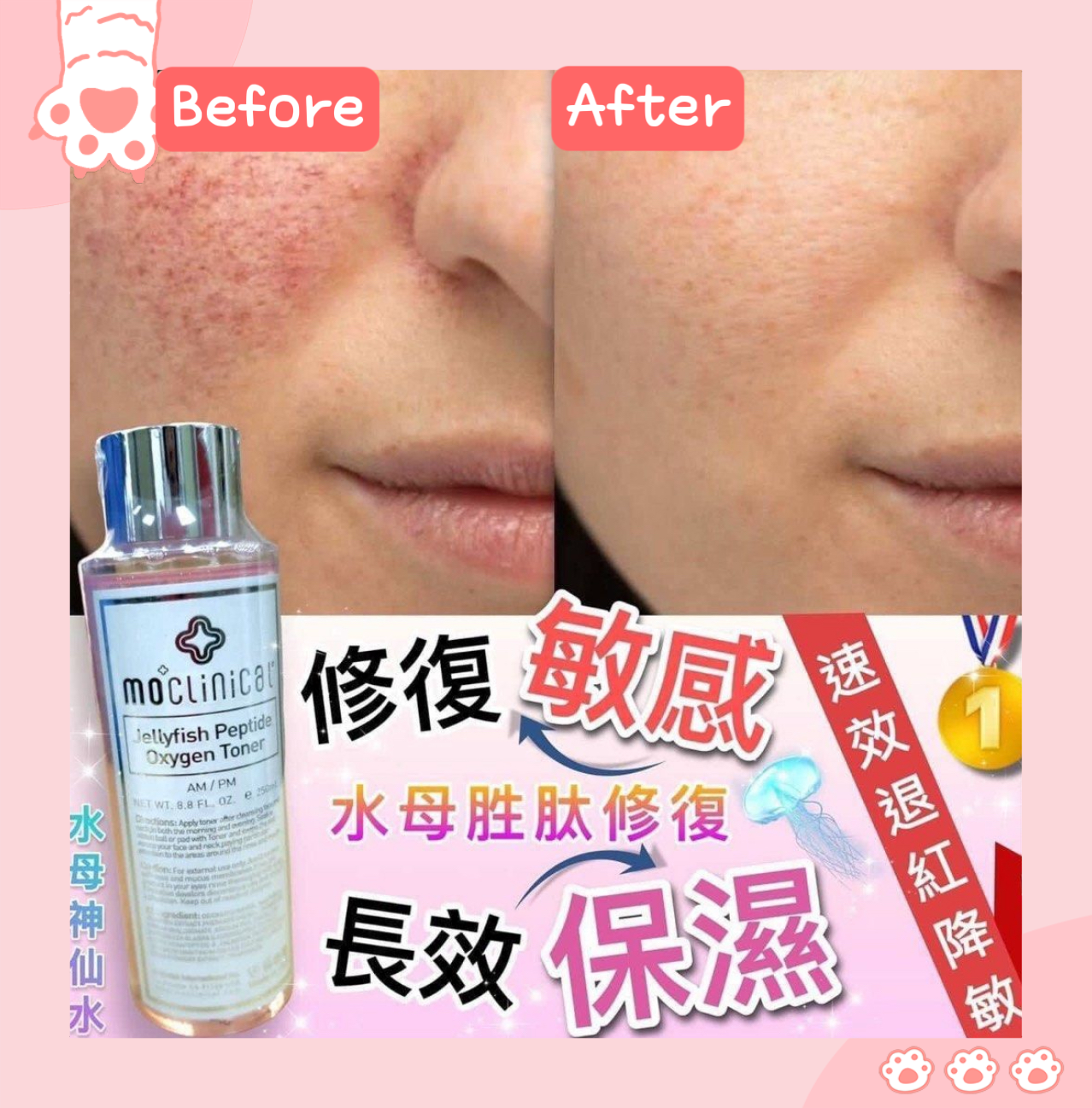 Moclinical水母神仙水250ml