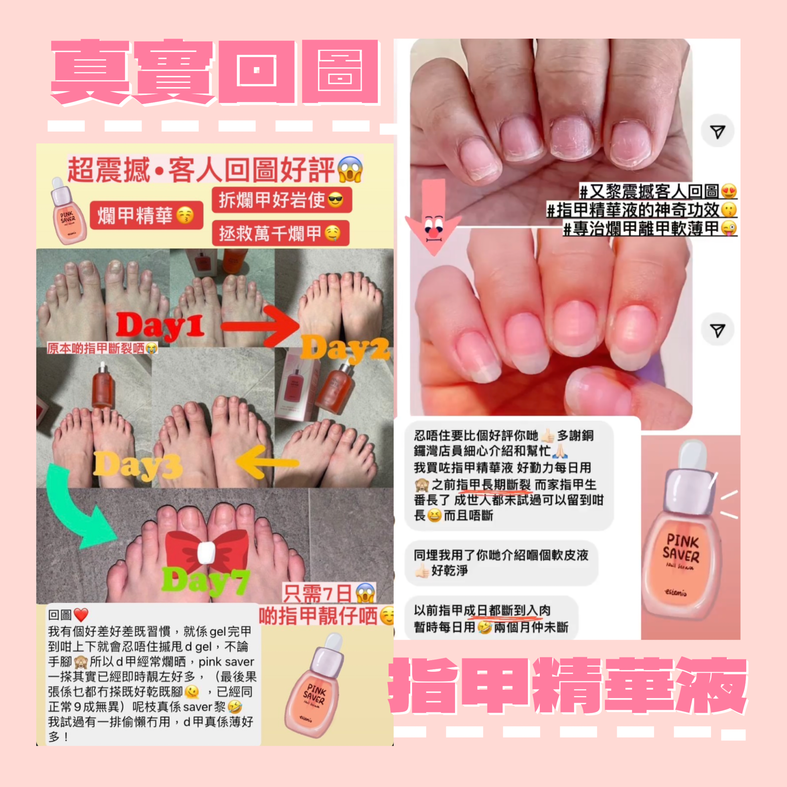 爛甲救星 指甲精華液 Pink Saver Nail Serum 100ml